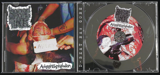 SPASTIC TUMOR - Autopsy Exploitation EP CD