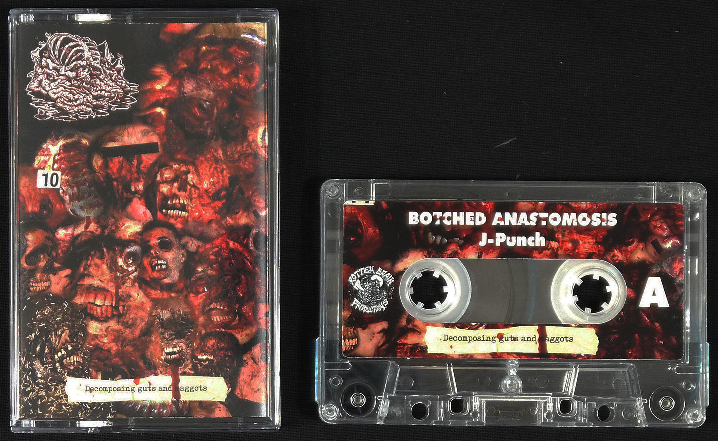 BOTCHED ANASTOMOSIS J POUCH - Decomposing Guts And Maggots MC Tape