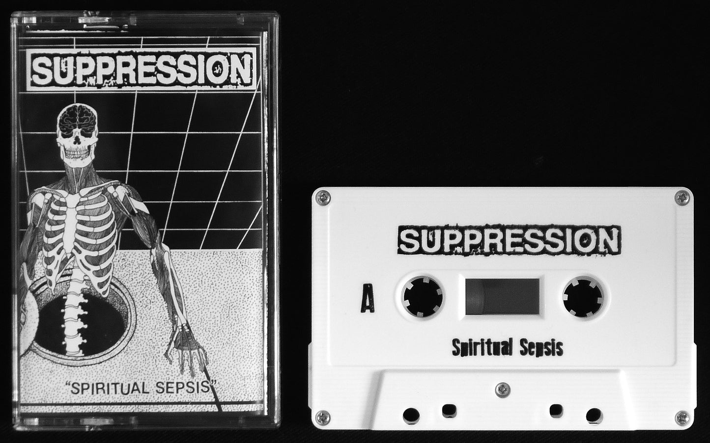 SUPPRESSION - Spiritual Sepsis MC Tape