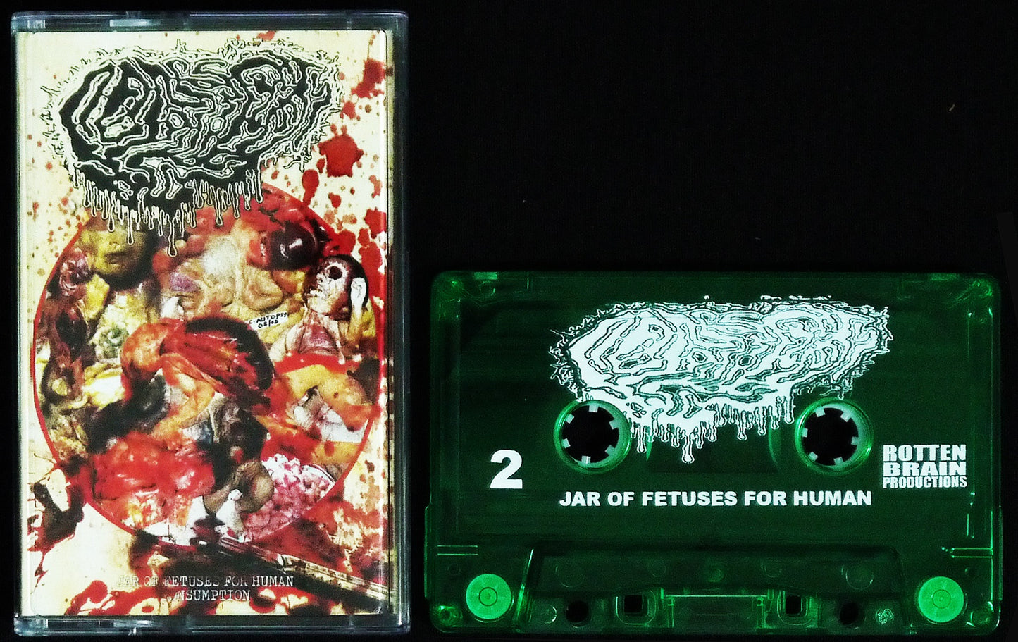 FETAL DEFORMITY - Jar of Fetuses for Human Consumption MC Tape