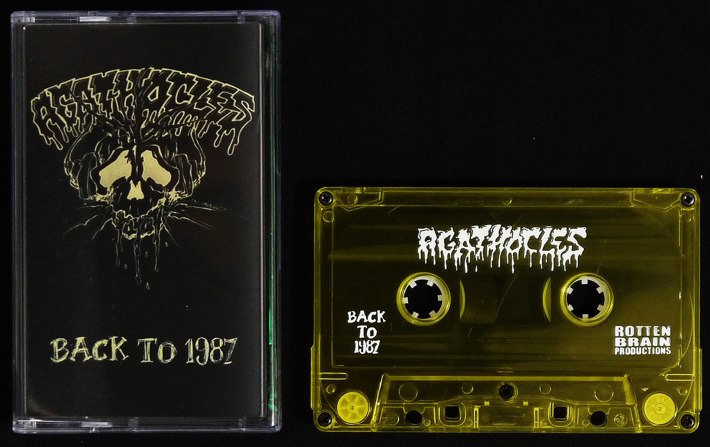 AGATHOCLES - Back To 1987 MC Tape