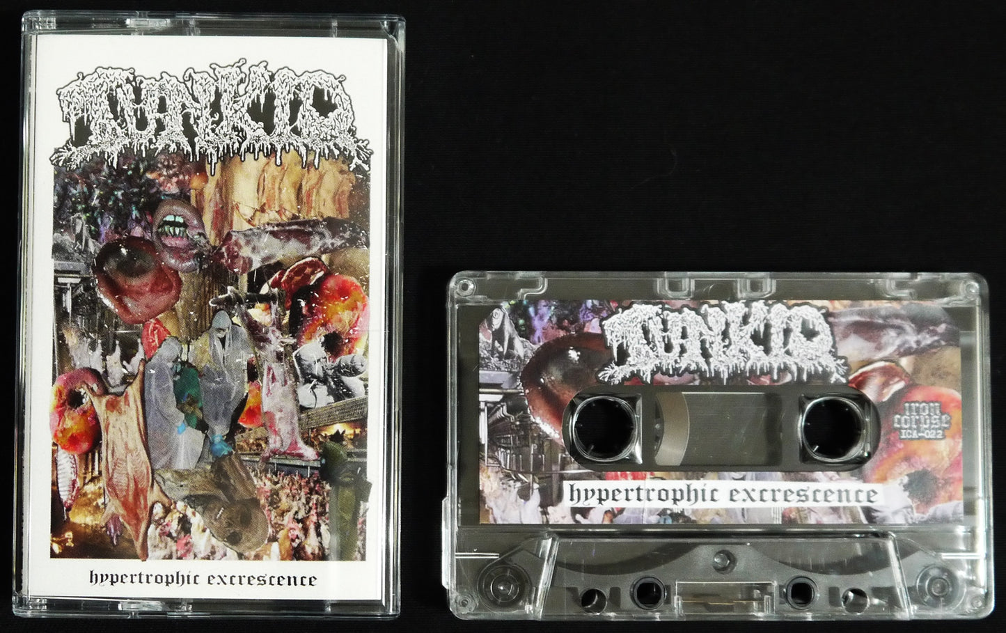 TUNKIO - Hypertrophic Excrescence MC Tape