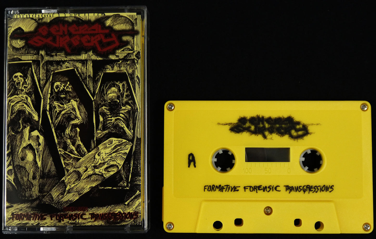 GENERAL SURGERY - Formative Forensic Transgressions MC Tape