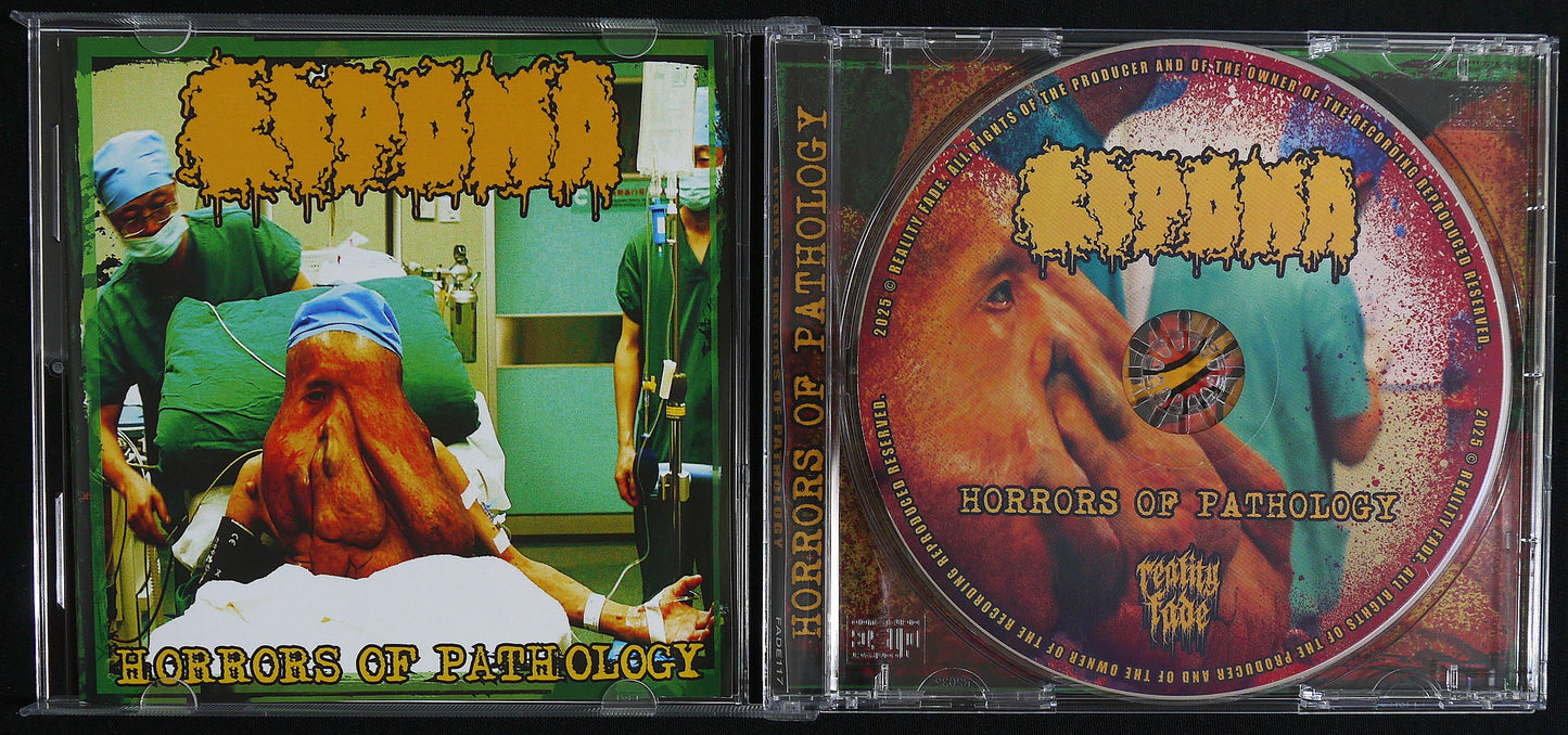 LIPOMA - Horrors Of Pathology CD