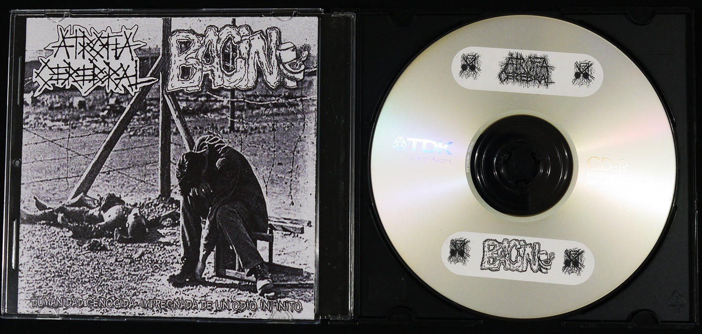 ATROFIA CEREBRAL / BACIN - Split CDr