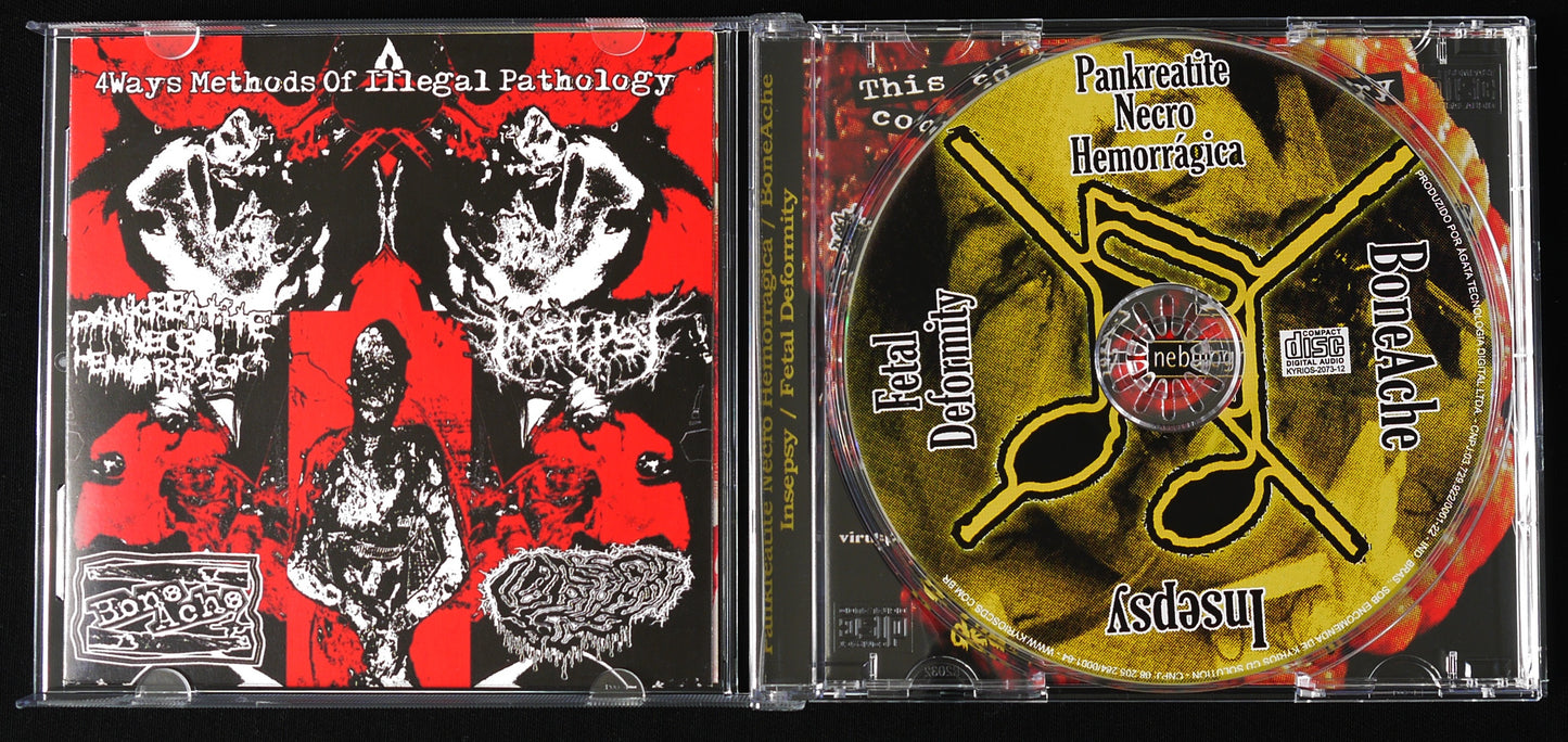 FETAL DEFORMITY / PANKREATITE NECRO HEMORRAGICA / BONEACHE / INSEPSY - 4 Way Split CD