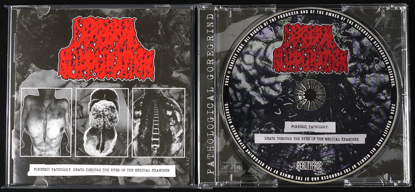 CEREBRAL SUPPURATION - Forensic Pathology CD