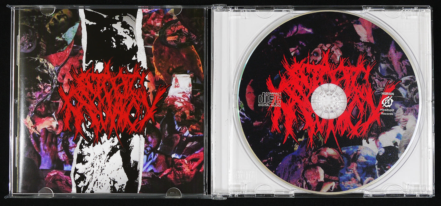 ECTOPIC PREGNANCY - Discography CD