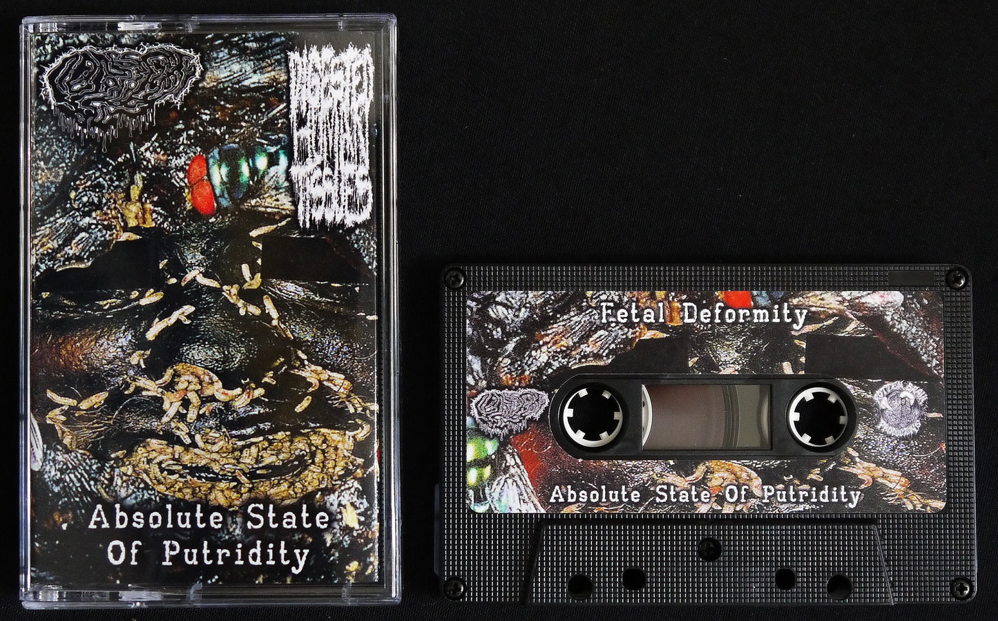FETAL DEFORMITY / DIGESTED HUMAN TISSUES - Split Tape