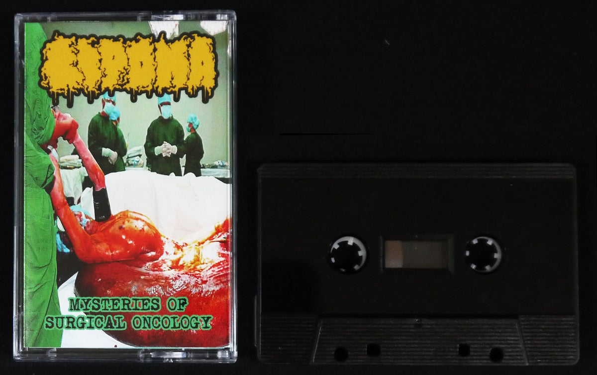LIPOMA / PSEUDOMONAS AERUGINOSA - Split Tape
