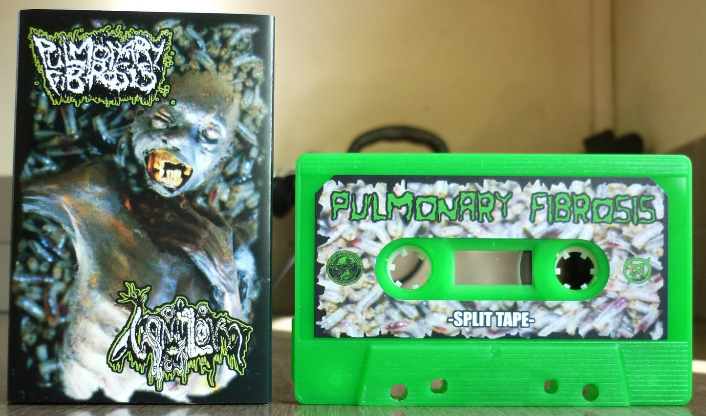 PULMONARY FIBROSIS / VOMITOMA - Split Tape