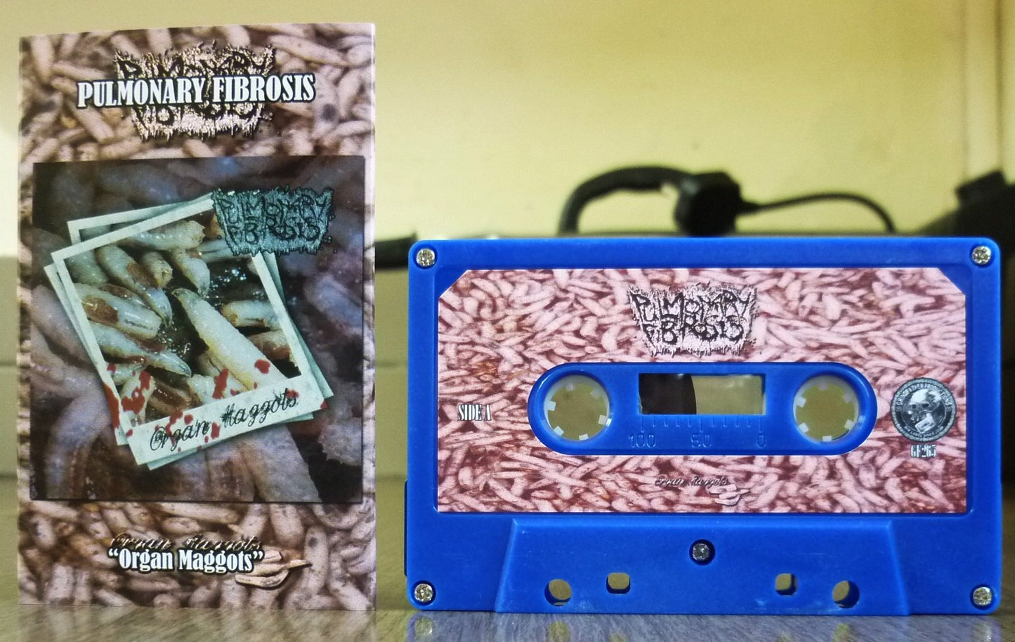 PULMONARY FIBROSIS - Organ Maggots Tape