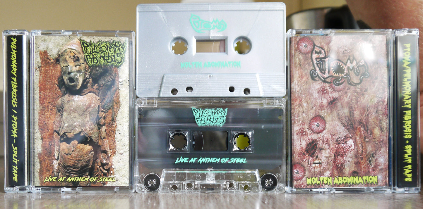 PULMONARY FIBROSIS / PTOMA - Split Tape