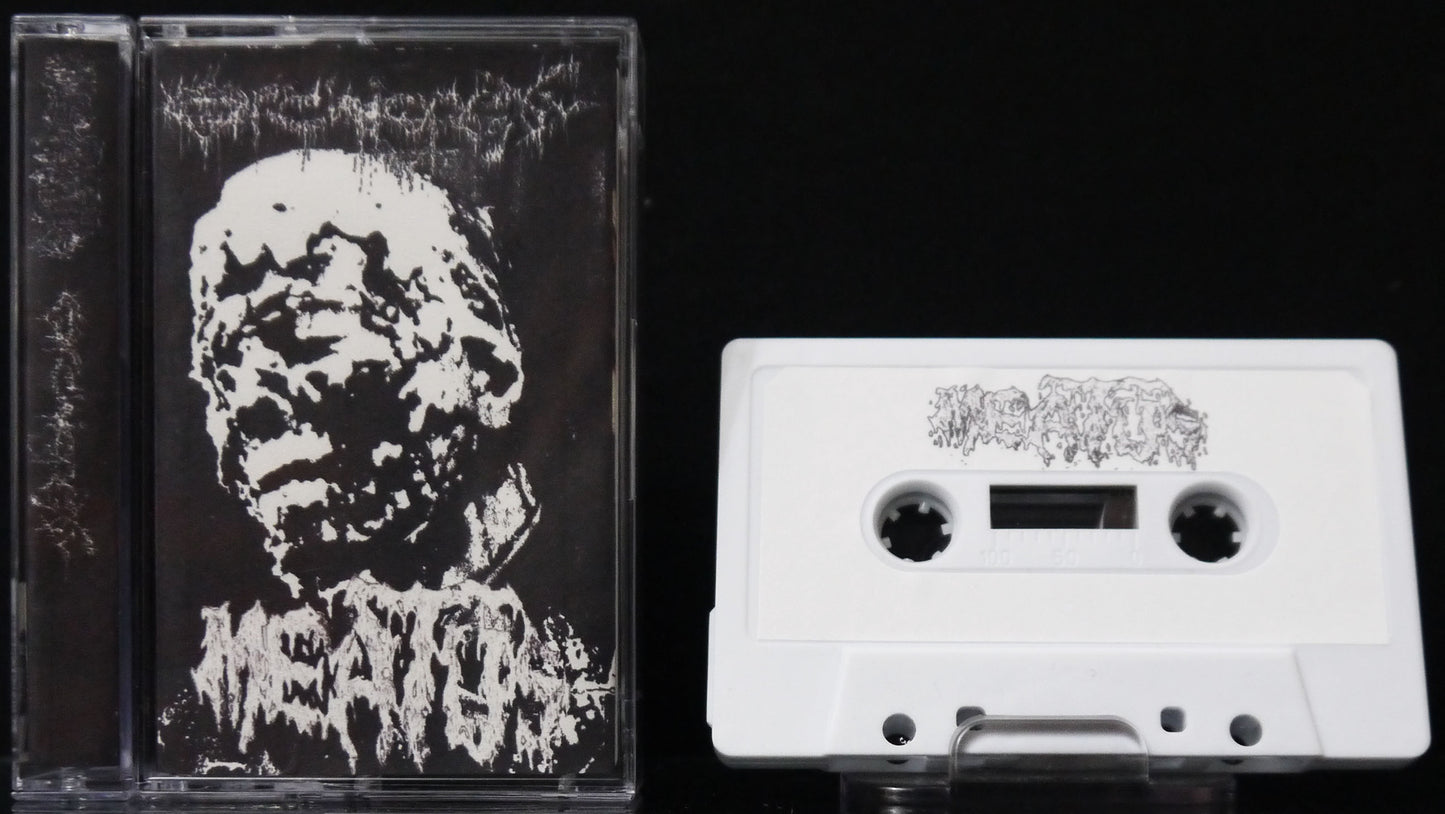 MEATUS / ORCHIOPEXY - Split Tape