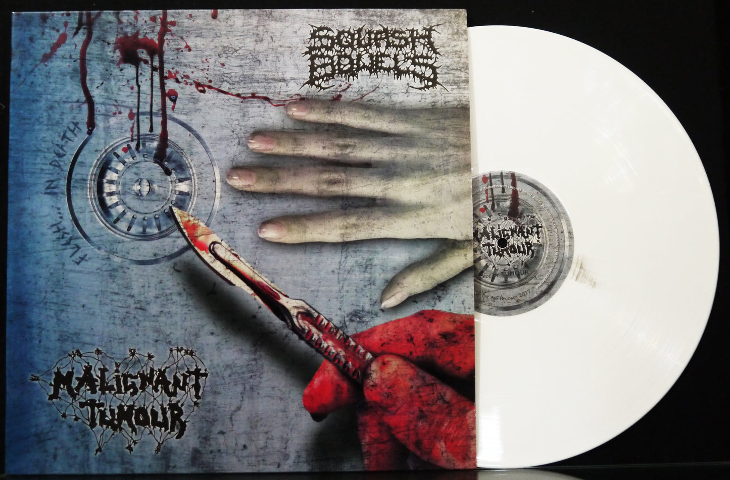 SQUASH BOWELS / MALIGNANT TUMOUR - Split 12"