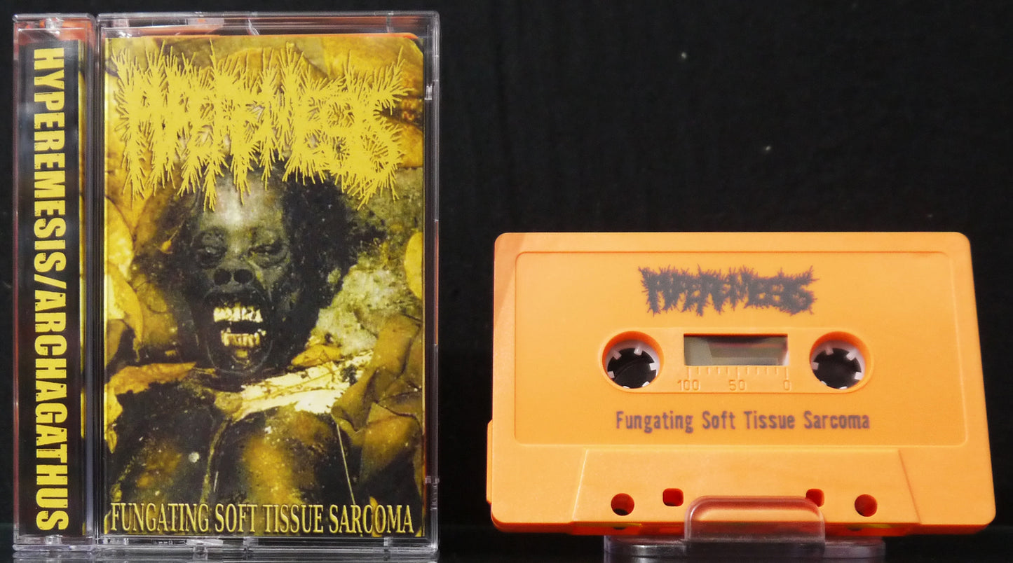 ARCHAGATHUS / HYPEREMESIS - Split Tape