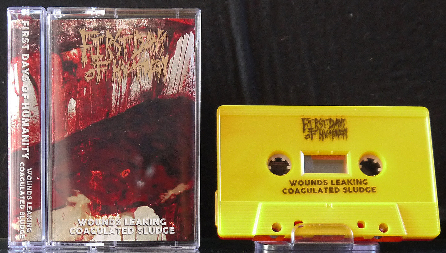 FIRST DAYS OF HUMANITY - Lithic / Wounds Leaking Coagulated Sludge MC Tape