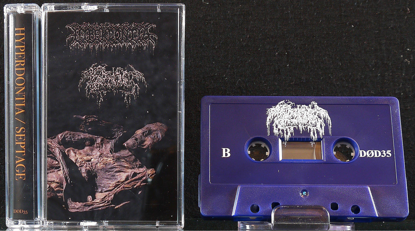 SEPTAGE / HYPERDONTIA - Split Tape