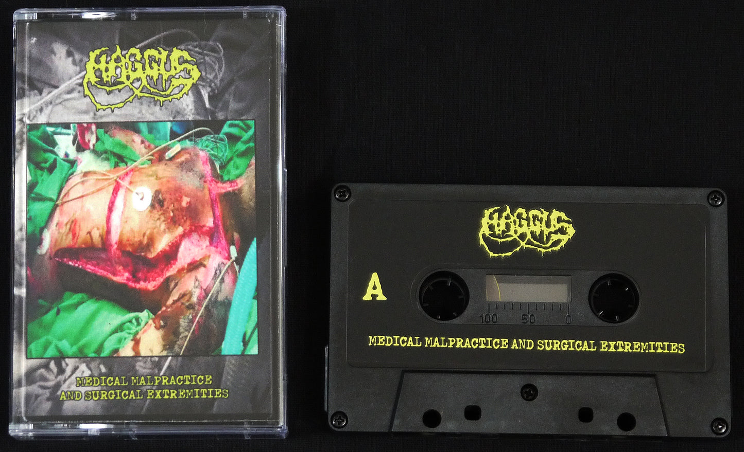 HAGGUS - Medical Malpractice And Surgical Extremities MC Tape