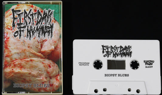 FIRST DAYS OF HUMANITY - Biopsy Blues MC Tape