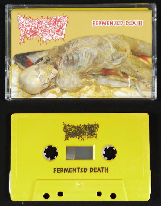 PURULENT REMAINS - Fermented Death/Stages Of Decomposition MC Tape