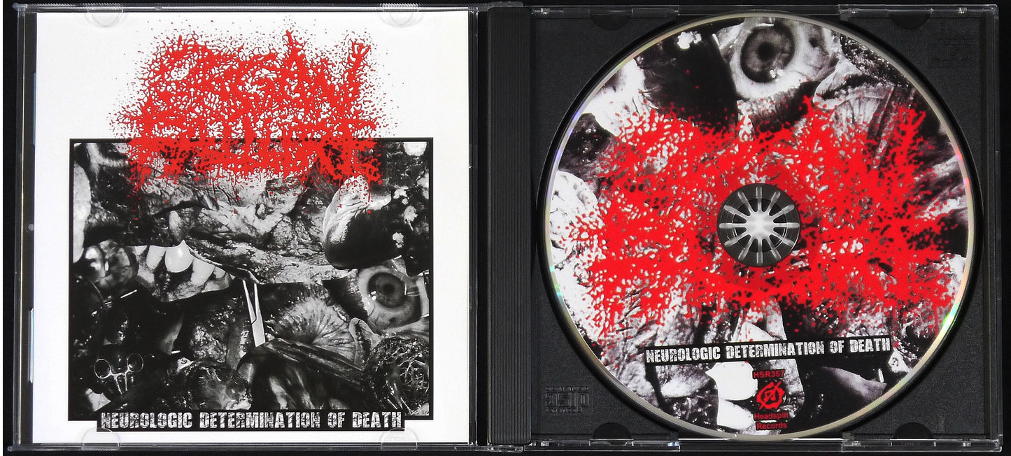 ORGAN FAILURE - Neurologic Determination Of Death CD