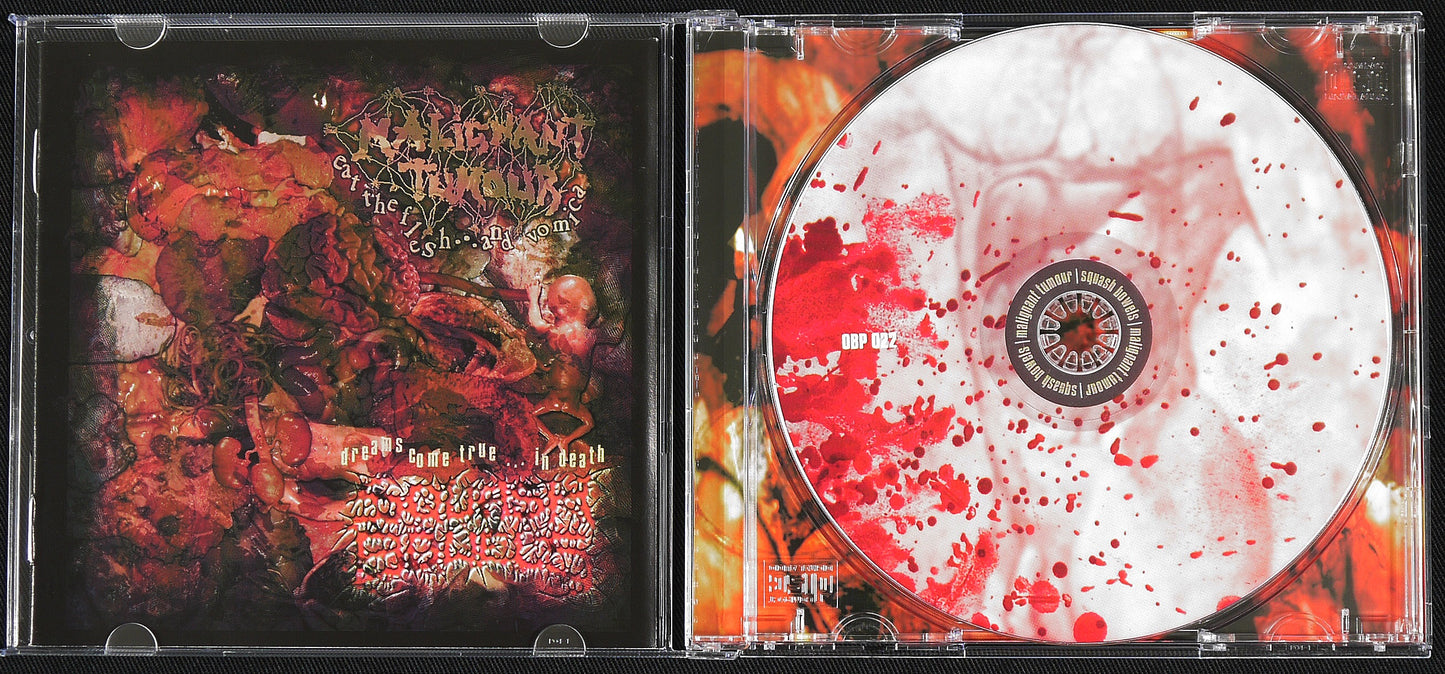 MALIGNANT TUMOUR / SQUASH BOWELS - Split CD