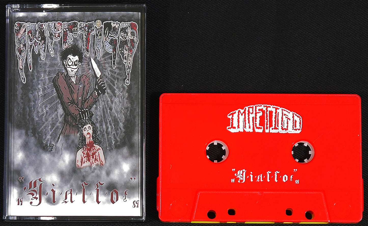 IMPETIGO - Giallo / Antefatto MC Tape