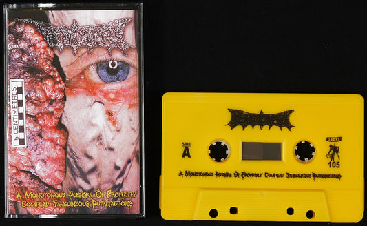 BIOCYST - A Monotonous Plethora Of Profusely Compiled Sanguineous Putrefactions MC Tape
