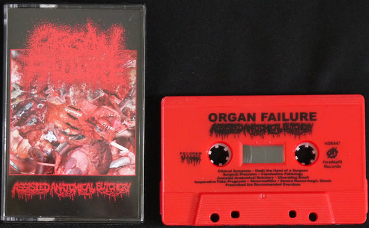 ORGAN FAILURE - Assisted Anatomical Butchery MC Tape