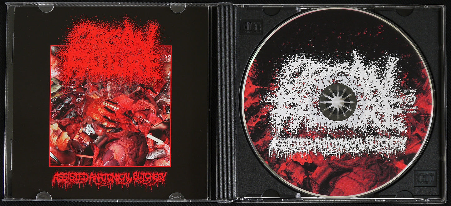 ORGAN FAILURE - Assisted Anatomical Butchery CD