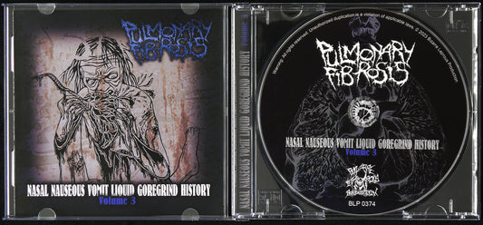 PULMONARY FIBROSIS - Nasal Nauseous Vomit Liquid Goregrind History Volume 3 CD