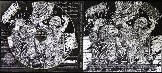 SULFURIC CAUTERY / CYSTGURGLE - Split DigiCD