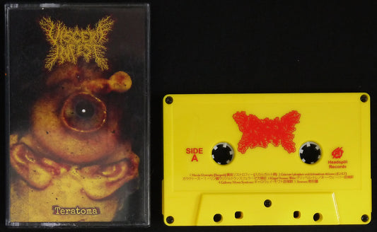 VISCERA INFEST - Teratoma MC Tape