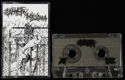 SULFURIC CAUTERY / MYXOMA - Split Tape
