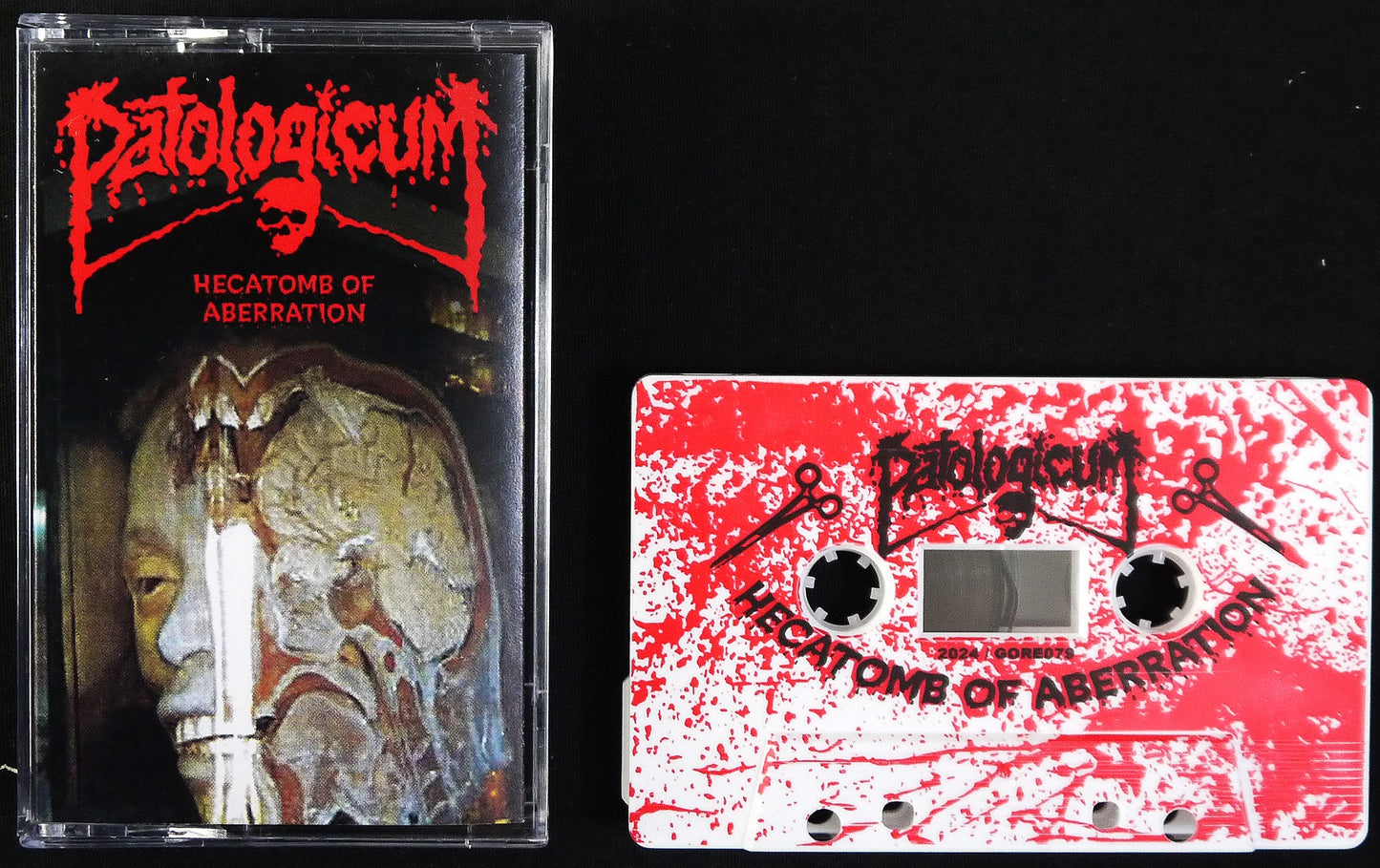 PATOLOGICUM - Hecatomb Of Aberration MC Tape