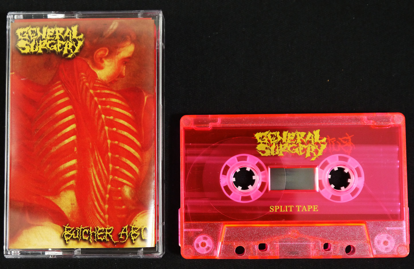 GENERAL SURGERY / BUTCHER ABC - Split Tape