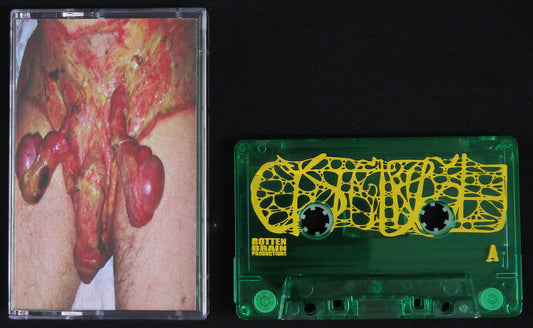 CYSTGURGLE - Grotesque Gangrene Towards Prolapsed Colostomy and Urogenital Myiasis MC Tape