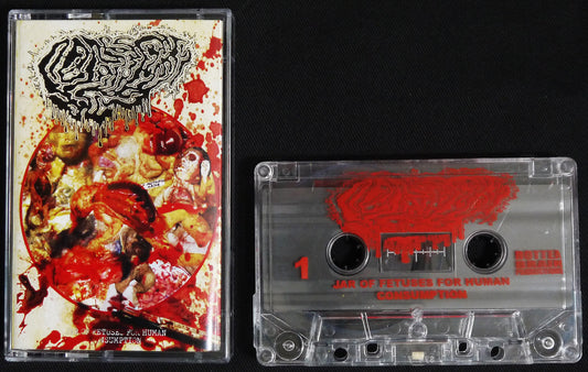 FETAL DEFORMITY - Jar Of Fetuses For Human Consumption MC Tape