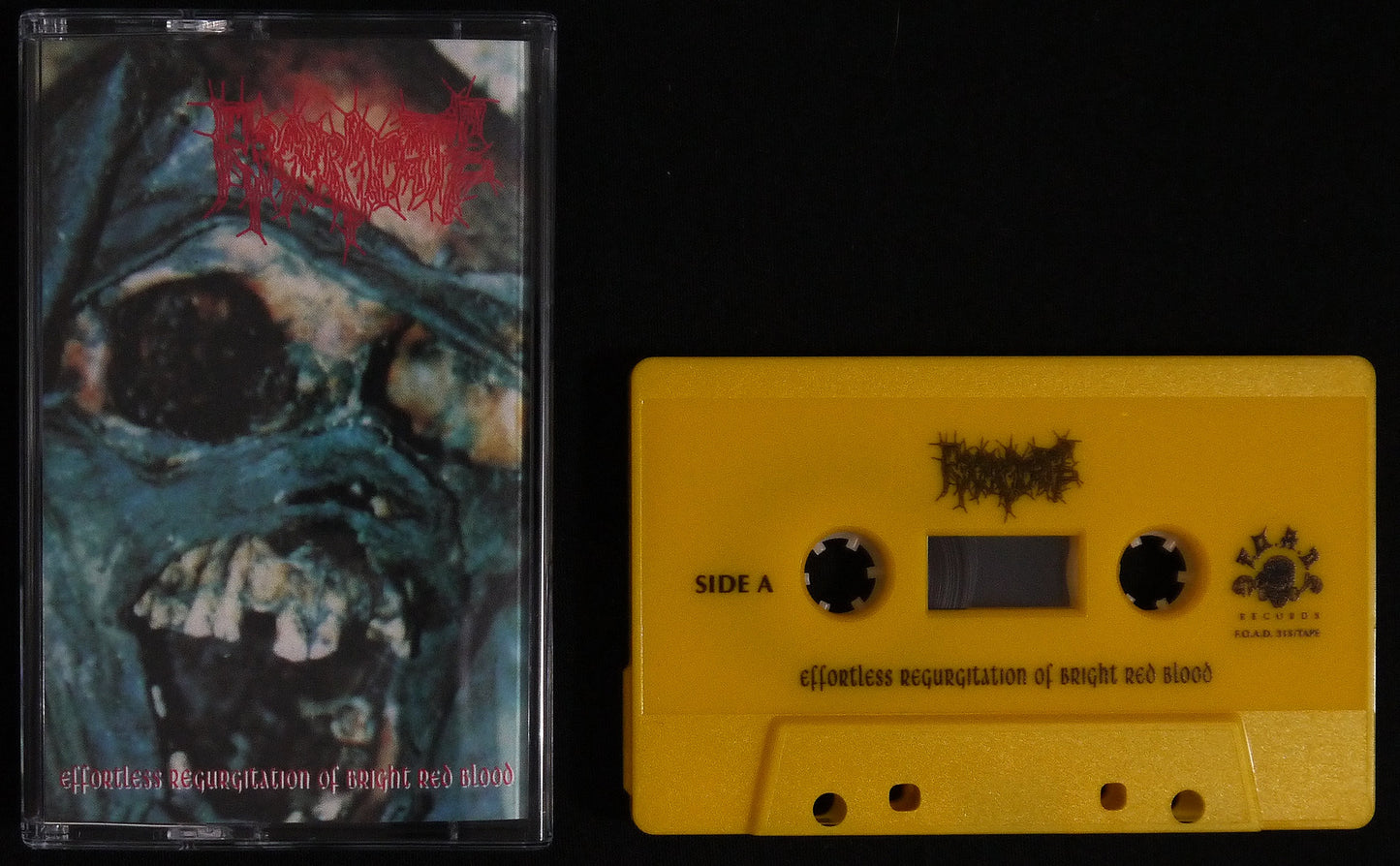 REGURGITATE - Effortless Regurgitation Of Bright Red Blood MC Tape