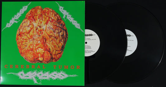 CARCASS - Cerebral Tumour 2x12"