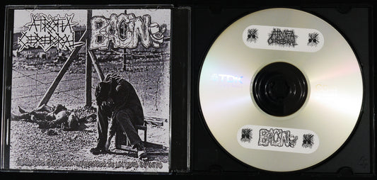 ATROFIA CEREBRAL / BACIN - Split CDr