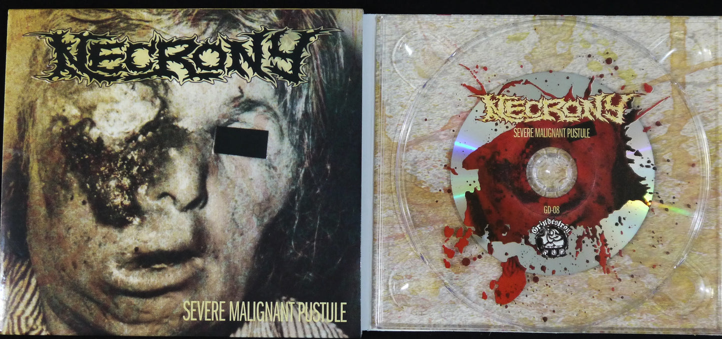 NECRONY - Severe Malignant Pustule DigiCD