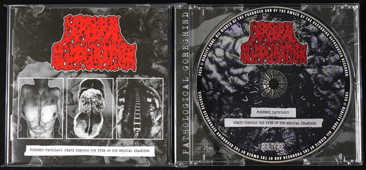 CEREBRAL SUPPURATION - Forensic Pathology CD