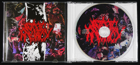 ECTOPIC  PREGNANCY - Discography CD