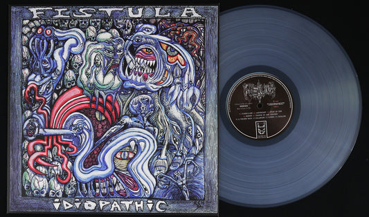 FISTULA - Idiopathic 12"