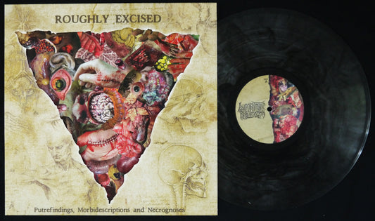 LYMPHATIC PHLEGM - Roughly Excised - Putrefindings, Morbidescriptions And Necrognoses 12"