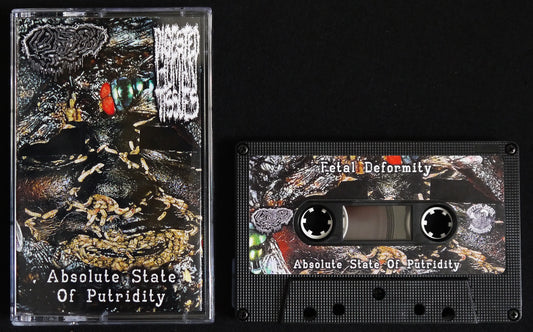 FETAL DEFORMITY / DIGESTED HUMAN TISSUES - Split Tape