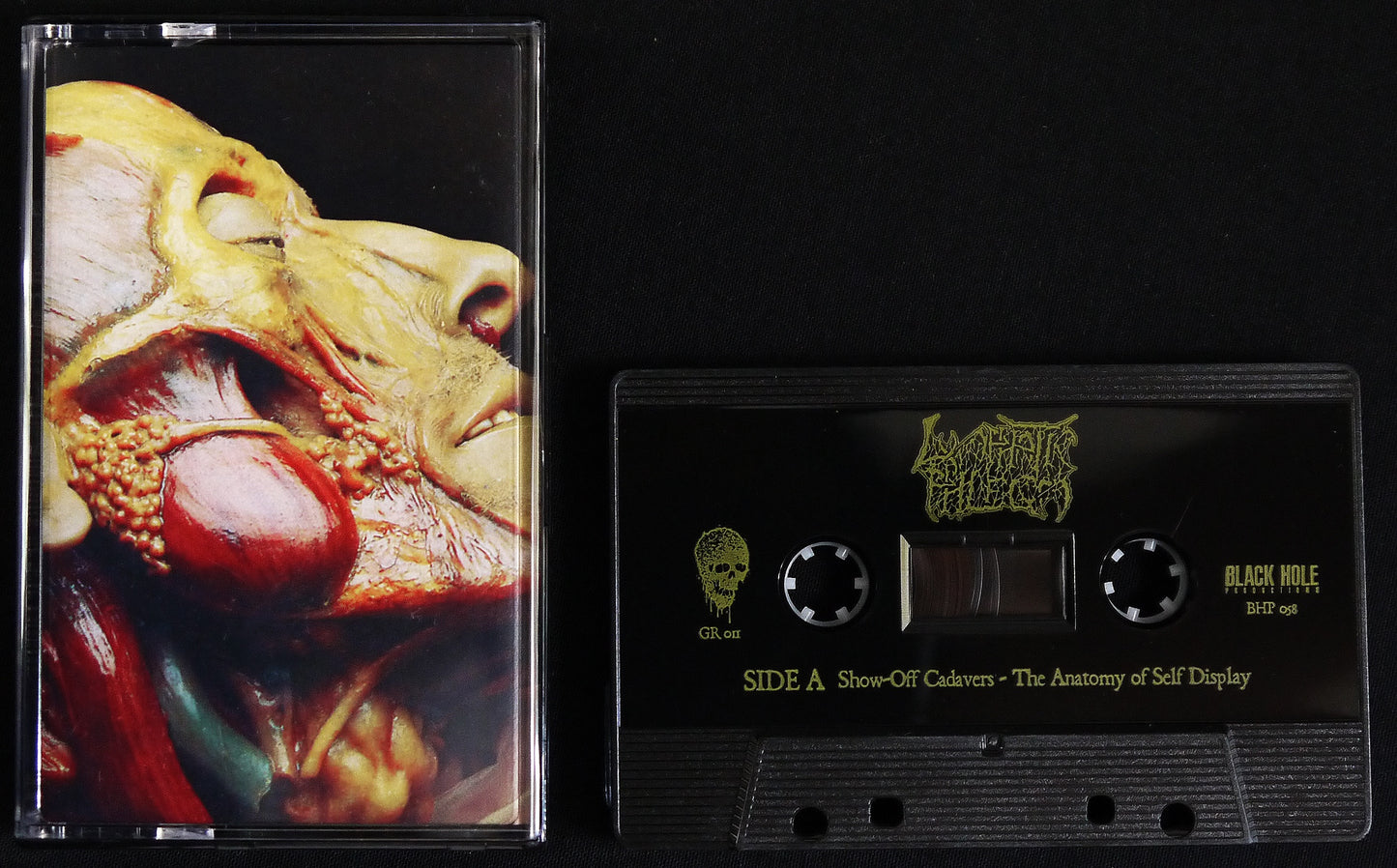 LYMPHATIC PHLEGM - Show-Off Cadavers - The Anatomy Of Self Display MC TAPE