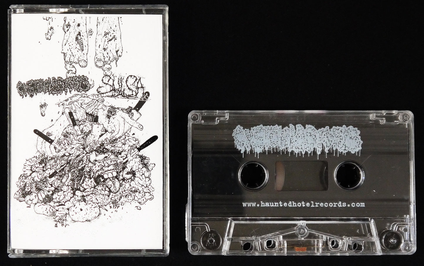 CYSTOBLASTOSIS / SULSA - Split Tape